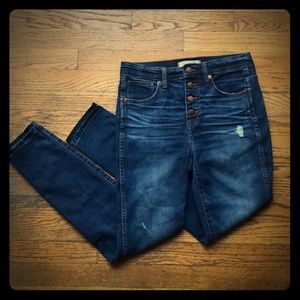 Madewell 10” High- Rise Buttoned Skinny Jeans